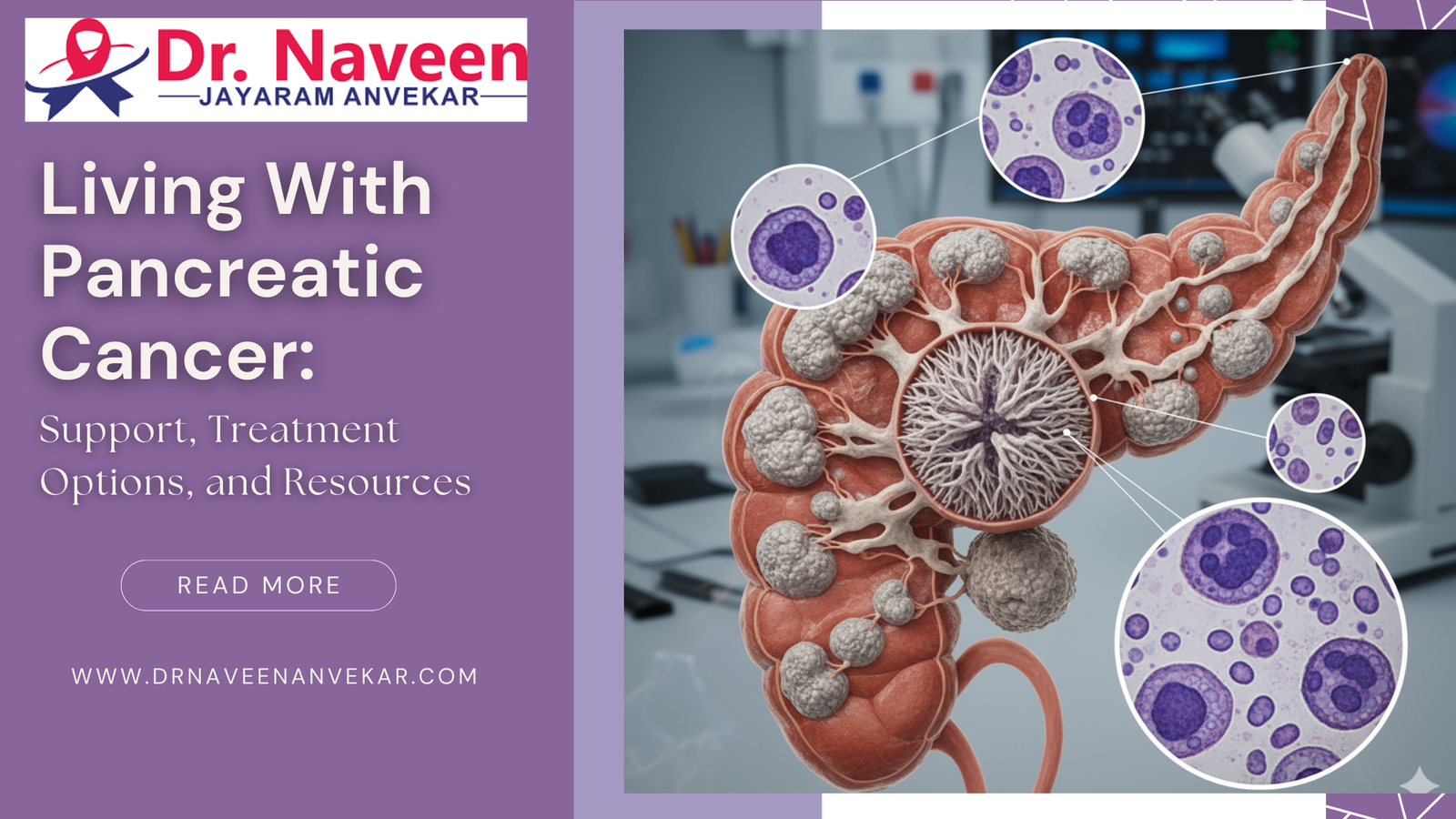 Living With Pancreatic Cancer: Support, Treatment Options, and Resources